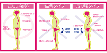 姿勢の悪さによる身体への負担