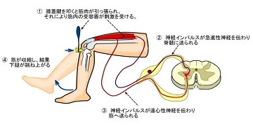 伸張反射（脊髄反射）のイメージ